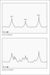 Bonne et mauvaise chromatographie